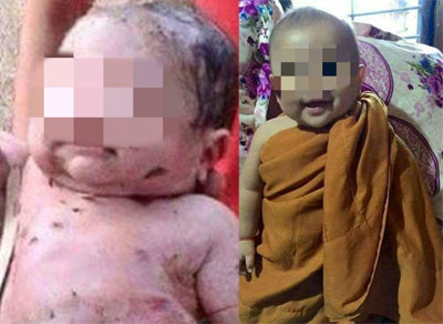 泰国婴儿被捅14刀并活埋仍存活 治愈后笑容暖心(图)