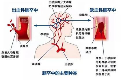 2019年10月28日广州黄埔将举办免费义诊