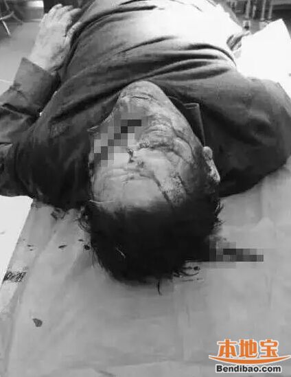 安徽医生被砍死 事发时医生正在睡觉