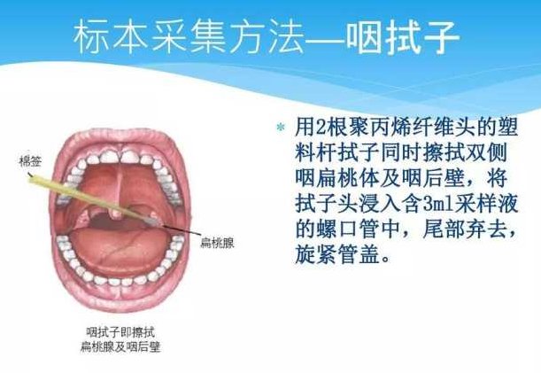 宁波市第九医院核酸检测是做咽拭子吗?
