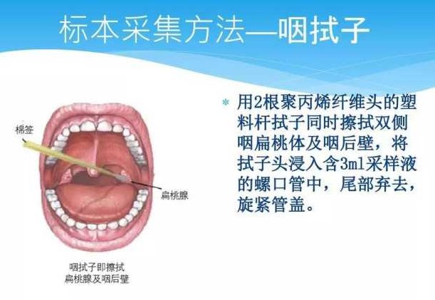 采核酸咽喉部具体部位图片