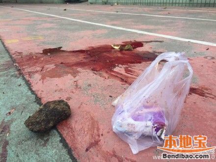 小学生遭校车碾压 因蹲地上捡东西