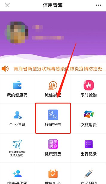 西宁信康码上可以查核酸检测报告结果吗怎么查